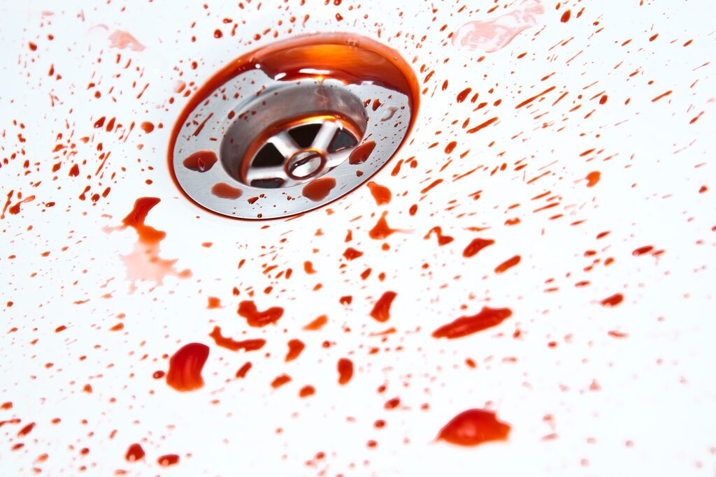 Verunreinigtes Waschbecken als Beispiel für den Bedarf einer Sonderreinigung